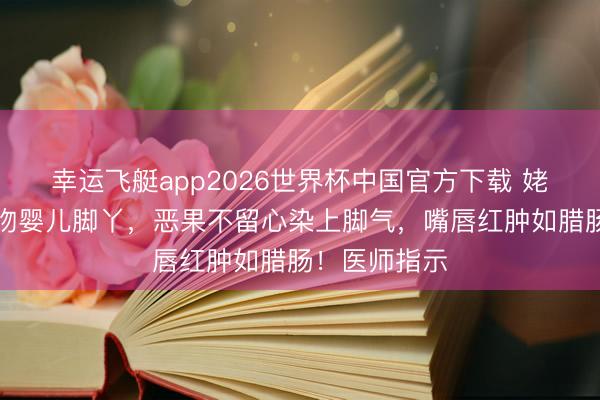 幸运飞艇app2026世界杯中国官方下载 姥姥不听劝亲吻婴儿脚丫,恶果不留心染上脚气,嘴唇红肿如腊肠!医师指示